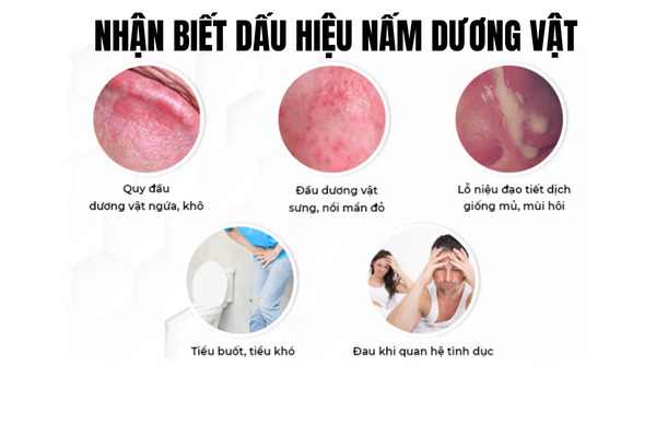 Nam-duong-vat-la-gi-va-lam-sao-dieu-tri-2