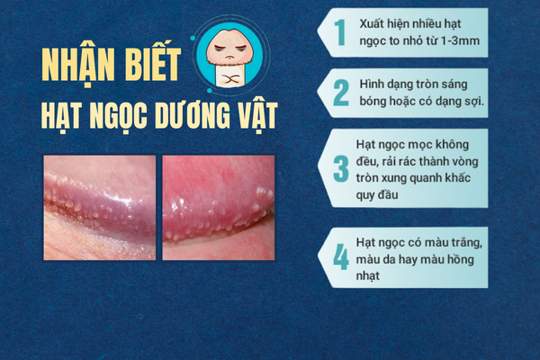 Nhan-biet-hat-ngoc-duong-vat