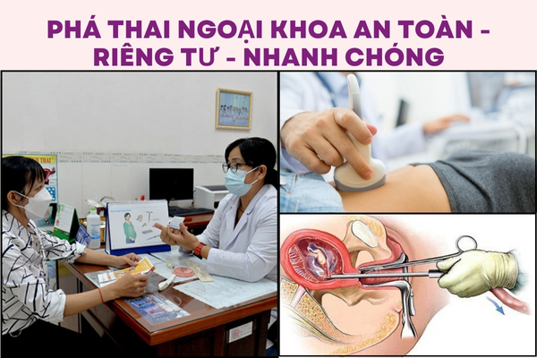 Phá thai ngoại khoa