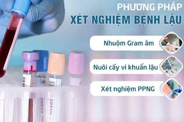 Xét nghiệm bệnh lậu – Cách nhận biết bệnh lậu sớm và chính xác 