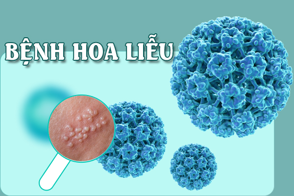 Bệnh hoa liễu là bệnh gì? Có chữa khỏi được không?