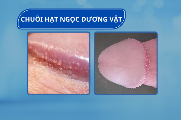 Cac-benh-o-duong-vat-nam-6