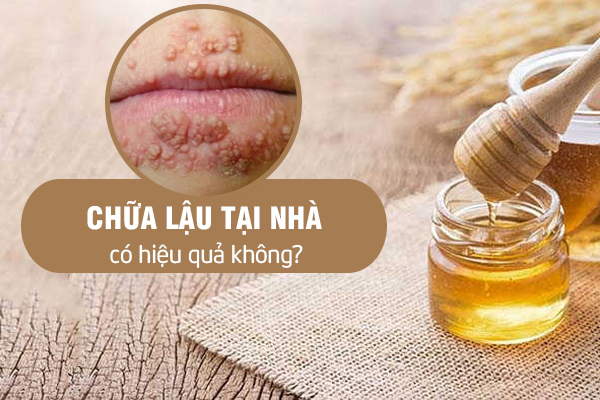 Chữa lậu tại nhà có hiệu quả và an toàn không?