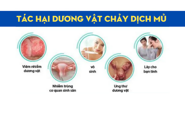 Duong-vat-chay-dich-mu-3