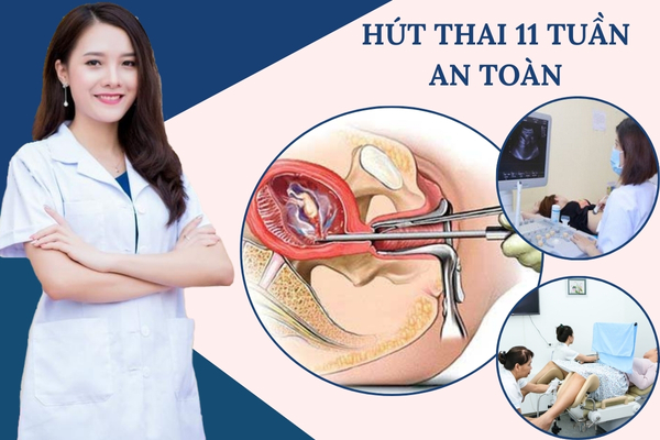 Hút thai 11 tuần có thực hiện được không? Địa chỉ bỏ thai lớn an toàn