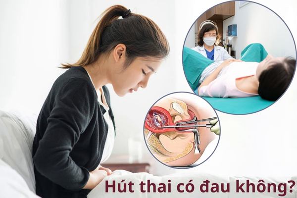 Hút thai có đau không? Phương pháp hút thai an toàn hiện nay