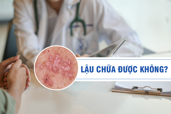 Bệnh lậu chữa được không? Phương pháp trị bệnh hiệu quả 