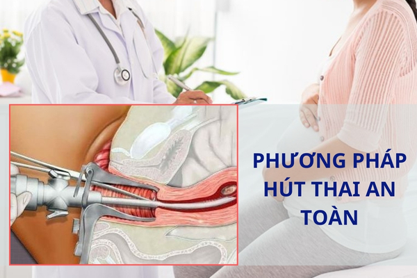 Phương pháp hút thai an toàn