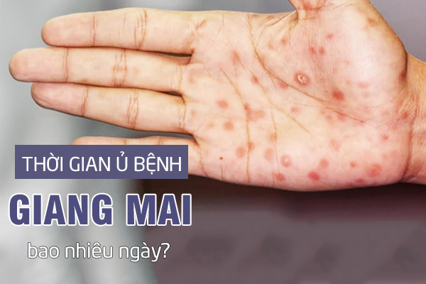 [Bác sĩ tư vấn] Thời gian ủ bệnh giang mai kéo dài trong bao lâu?