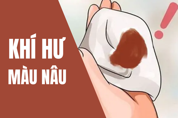 Hiểu đúng khí hư màu nâu để điều trị hiệu quả